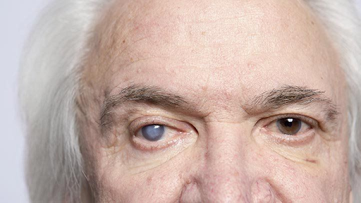 understanding-common-eye-conditions